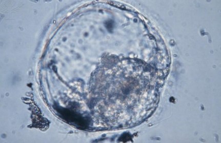 blastocisto, células-tronco
