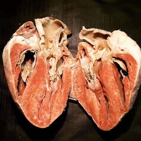 coração humano e tecido muscular