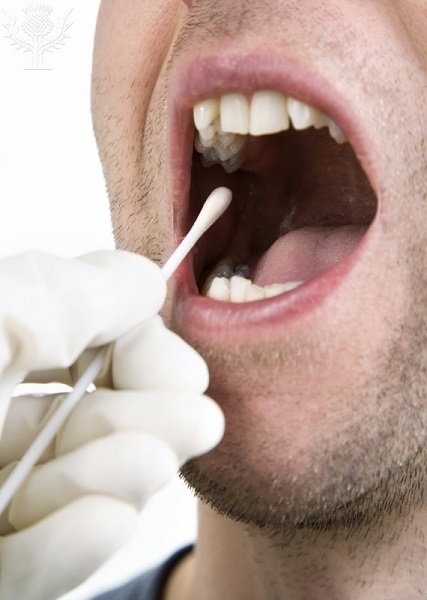 Coleta de material da mucusa oral para teste de DNA