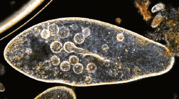 classificação dos seres vivos - protozoário