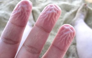 osmose e dedos enrugados