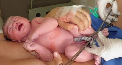 cordão umbilical