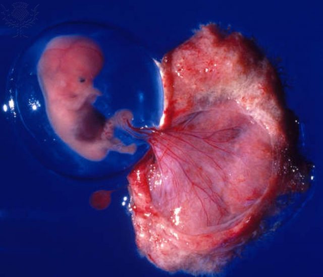 embrião saco amniótico