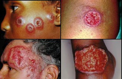 doenças causadas por protozoários