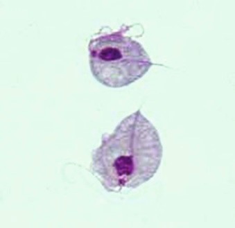 doenças causadas por protozoários