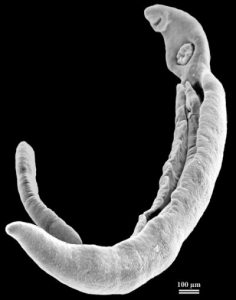 Schistosoma Mansoni
