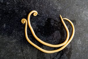ascaris lumbricoides ascaridíase