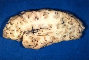 cérebro humano