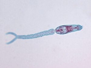 cercária esquistossomose
