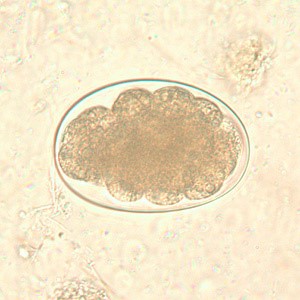 ovo de Necator americanus