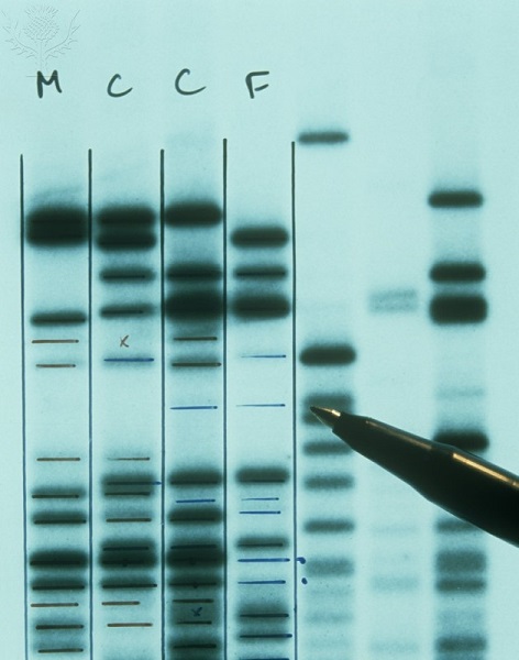 Bandas de DNA