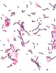 bacterias e reproduçao assexuada